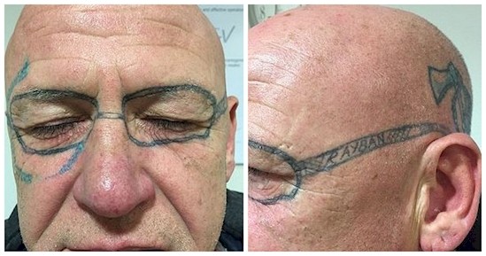 silmälasit tatuoituna miehelle
